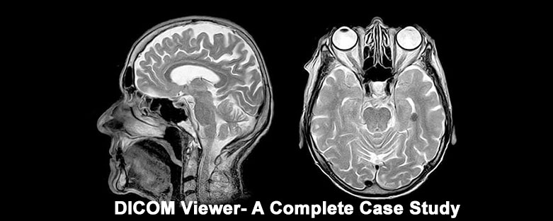 dicom-viewer-a-complete-case-study