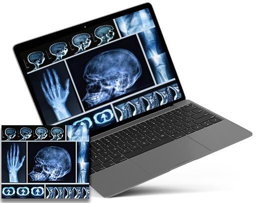 dicom